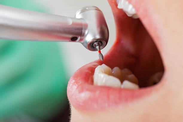 Best Emergency TMJ Treatment in Fredericksburg, VA